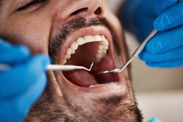 Best Broken or Chipped Tooth Repair in Villa Ridge, MO