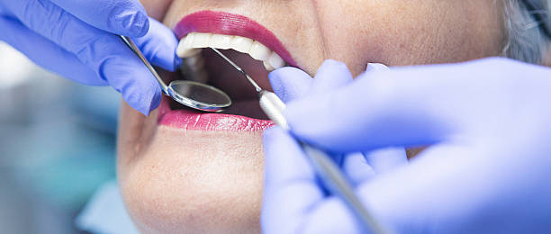 Best Emergency Wisdom Tooth Extraction in Villa Ridge, MO